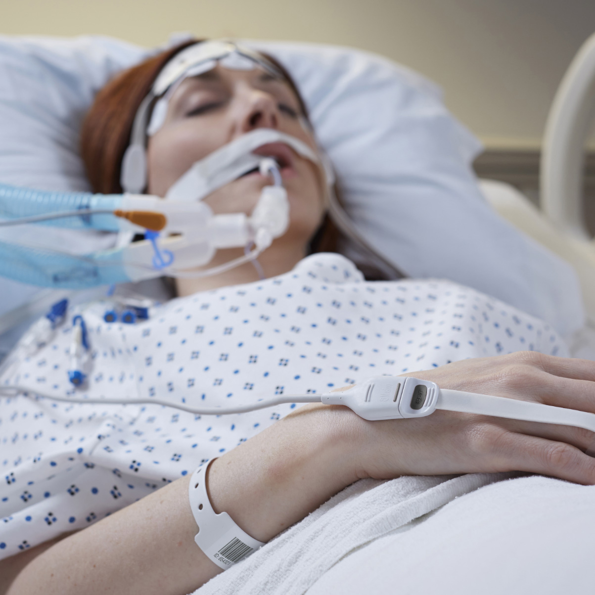 Sleeping patient intubated in hospital bed being monitored with a Masimo RD SET sensor.